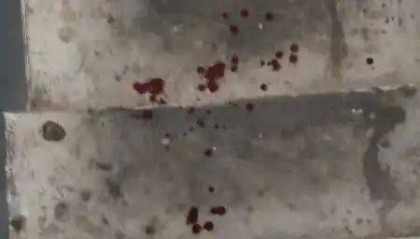 男子斥责遛狗不拴绳被打出血，次日送娃上学遭挑衅尾随，狗主人已被刑拘