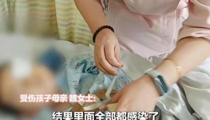 江西一5岁男孩在幼儿园被戳伤致左眼失明，家长称老师用猪油涂抹试图消肿